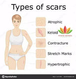 Kelo Cote Kelo-cote for Keloid After Surgery Marks Kelo-cote Silicone Gel surgical scar repair gel